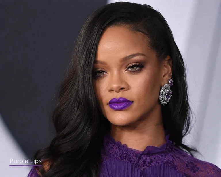 Purple Lips Causes, Symptoms, and When to Worry 2026